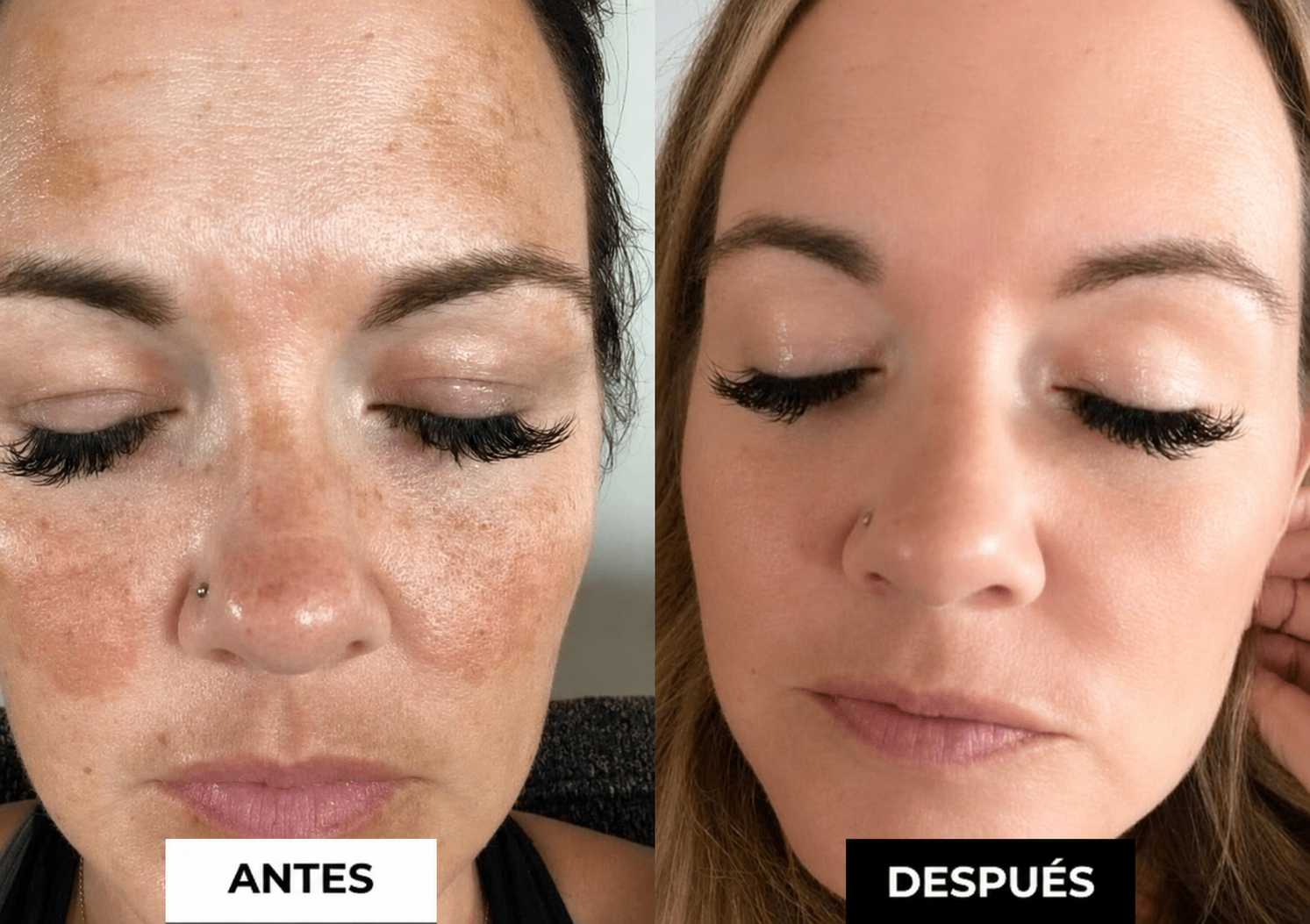Antes y Después — María