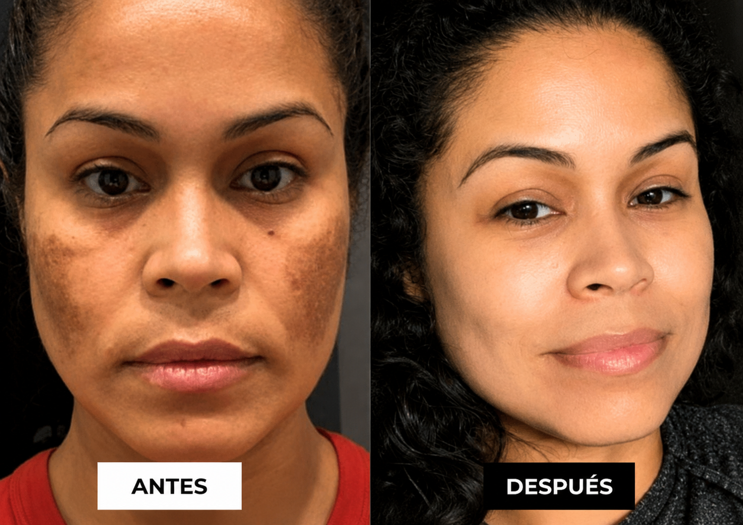 Antes y Después — Patricia
