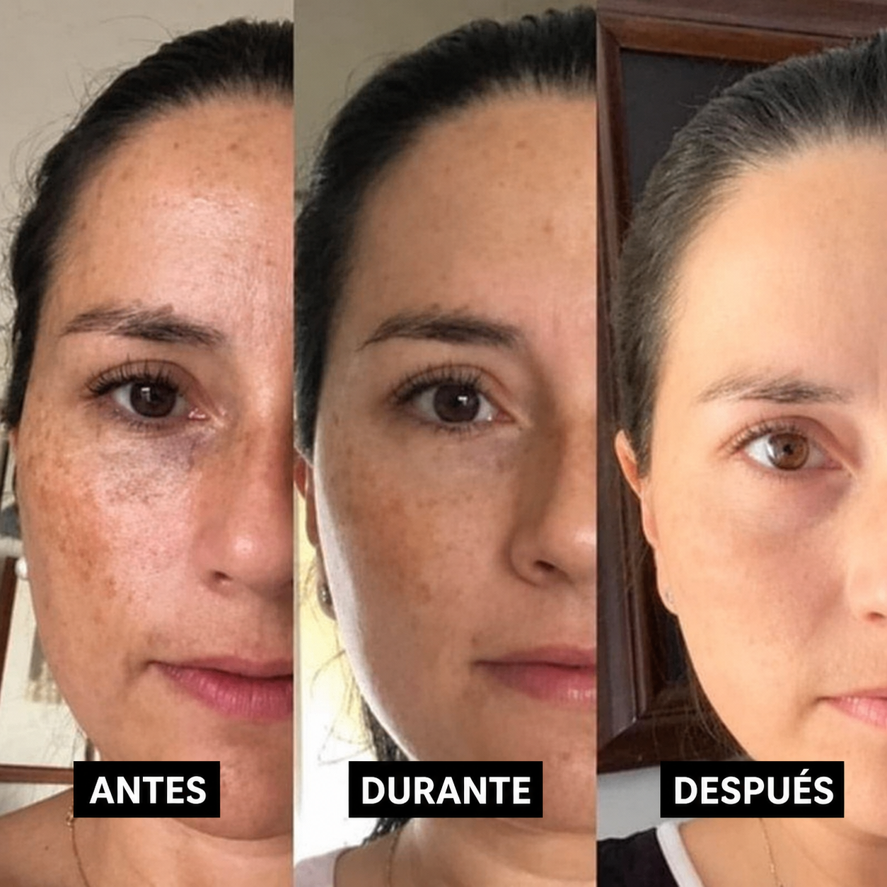 Antes, Durante y Después — Lorena