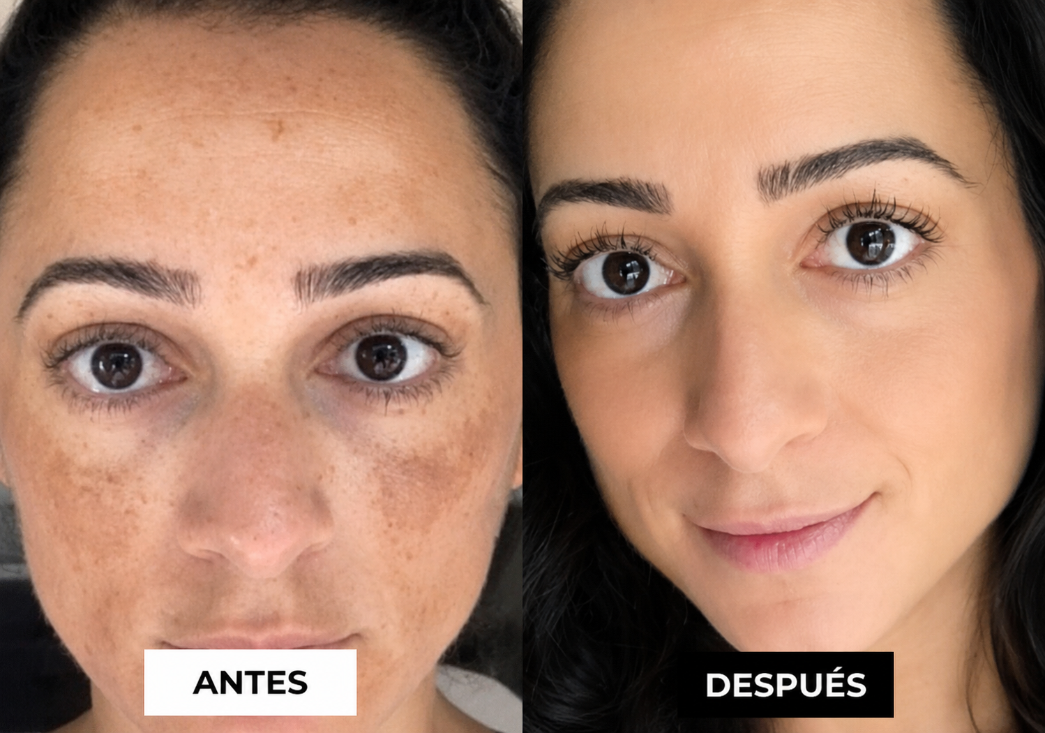 Antes y Después — Carmen